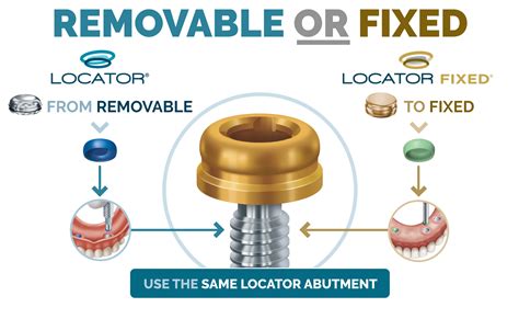 zest locator implants